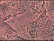 Gardnerella - Bakt. Kolpitis.mpg