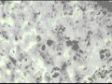 Sims-Huhner-test