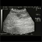 https://www.gyn.gr/images/Mamma-Ca_fall_3.jpg
