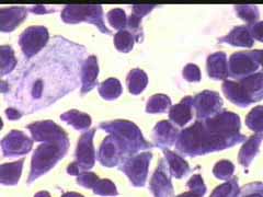 https://www.gyn.gr/images/RIU_3__2003_HERPES.jpg