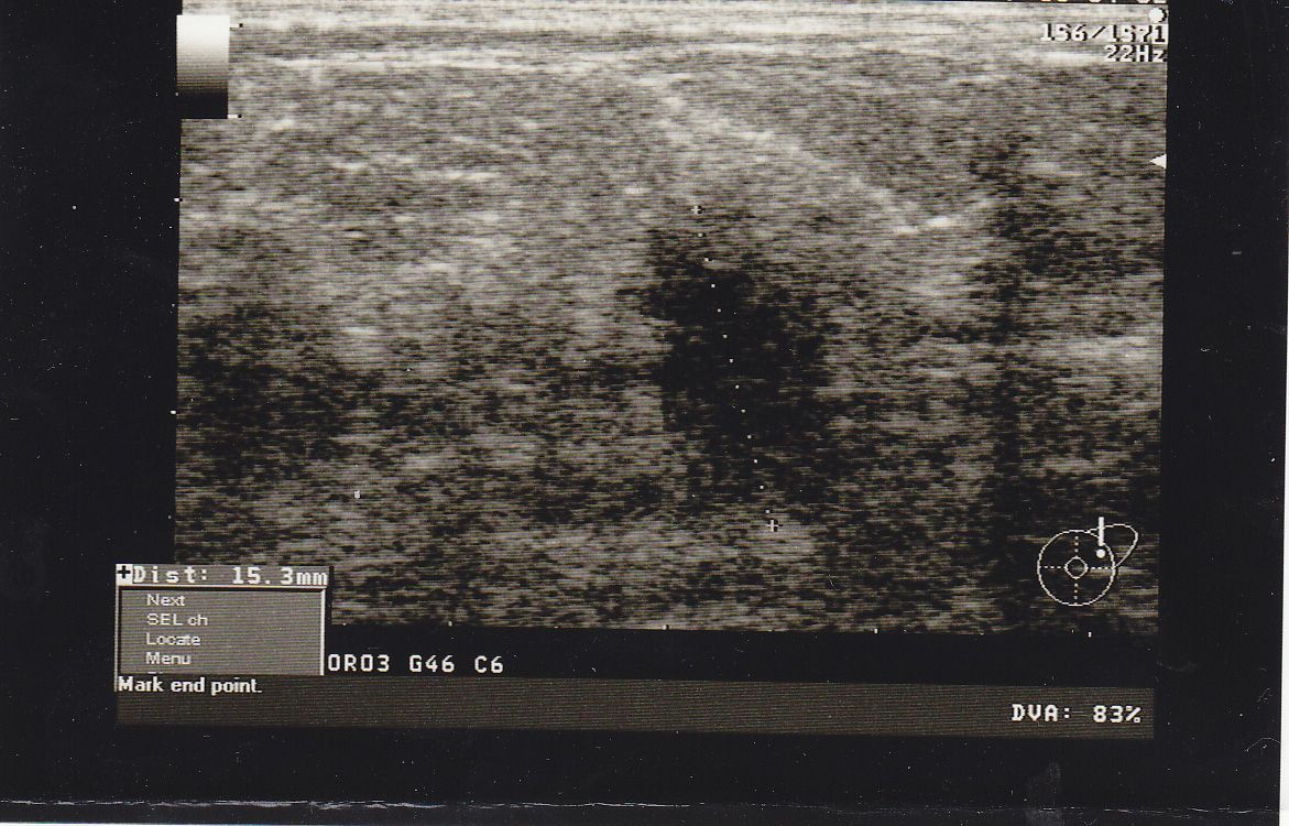 https://www.gyn.gr/images/ZHNO.jpg