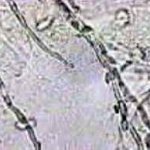 https://www.gyn.gr/images/phocagallery/thumbs/phoca_thumb_m_candida%206.jpg